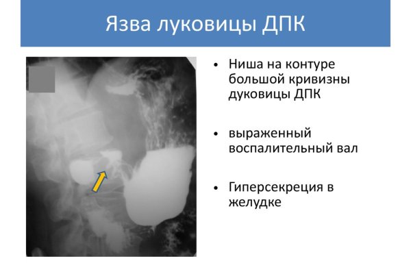 Кракен ссылка работает